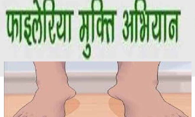 राजिम और छुरा क्षेत्र में 27 फरवरी से 13 मार्च तक चलेगा फाइलेरिया उन्मूलन कार्यक्रम